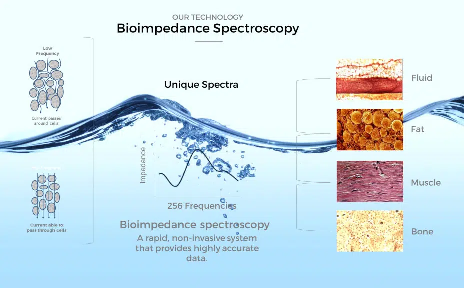 Bioimpedance spectroscopy ( BIS) is the only non invasive , low cost, techmology that can accurately measure a patients’ total body water,extracellular and intracellular fluid volumes in a clinical setting. This data facilities early detection , assessement and inetrventuions for chronic medical conditions.